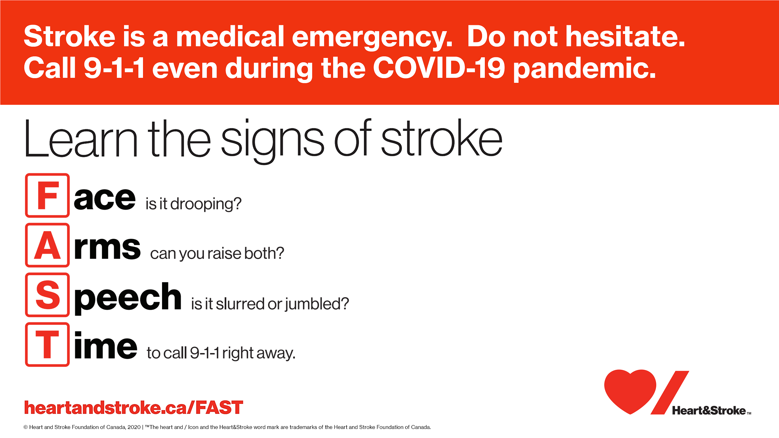 Signs of Stroke: FAST - Call 911 even during COVID-19